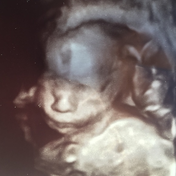 Meet your Posher, Eric - Picture 1 of 1